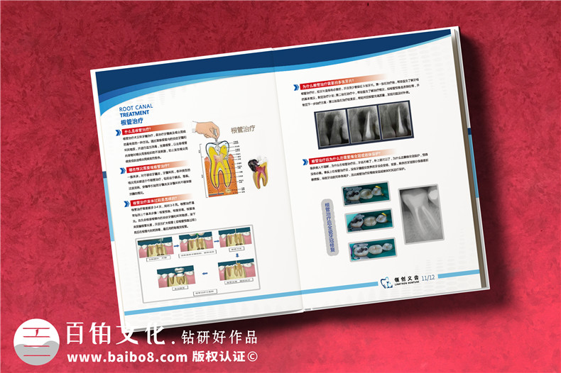 义齿画册怎么做-精装高档的义齿制作公司产品宣传册